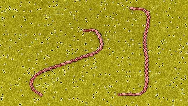 Ảnh 1: Xoắn khuẩn Leptospira gây bệnh trên heo